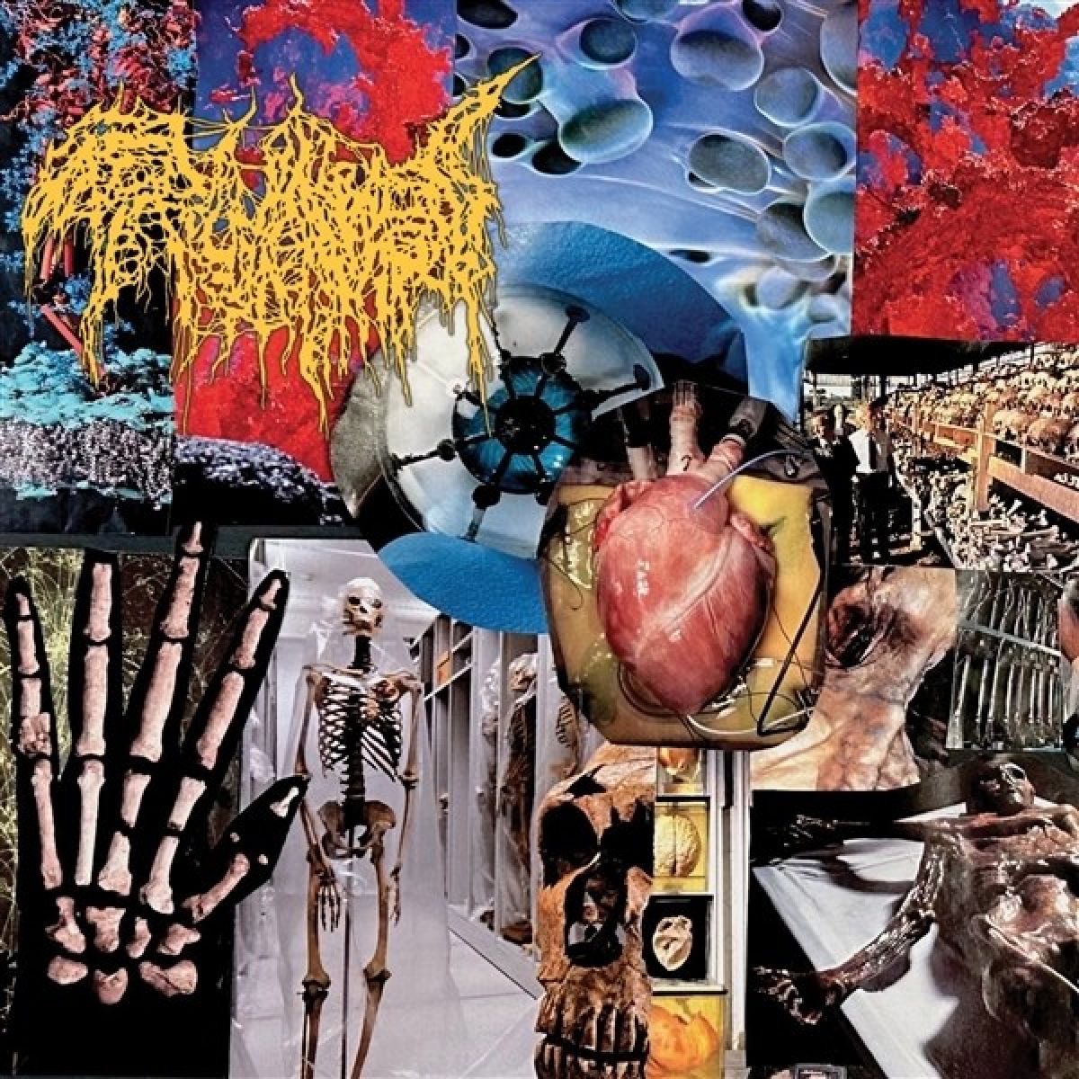 Afbeelding van Trichomoniasis - Harvest Of The Killing Fields