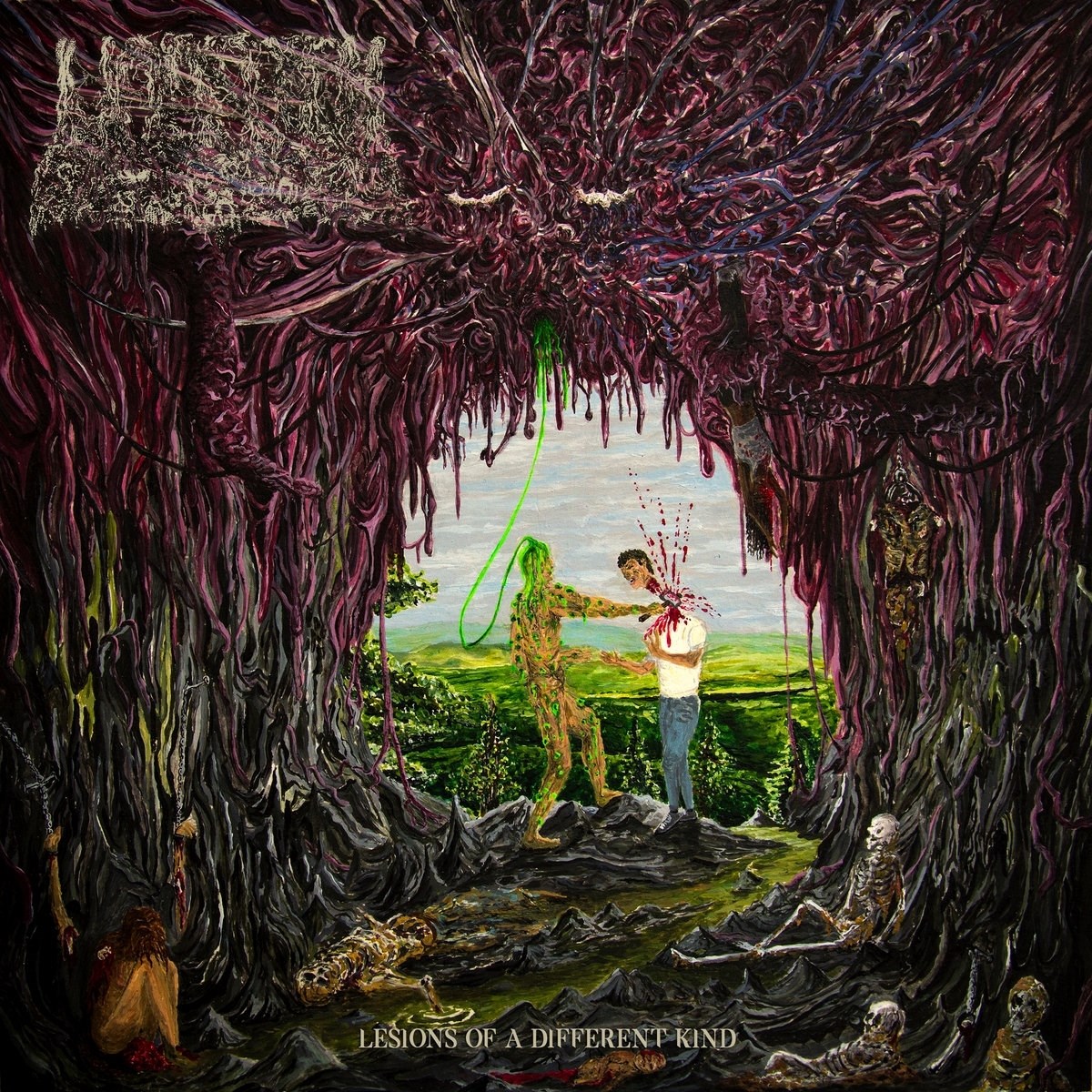 Afbeelding van Undeath - Lesions Of A Different Kind