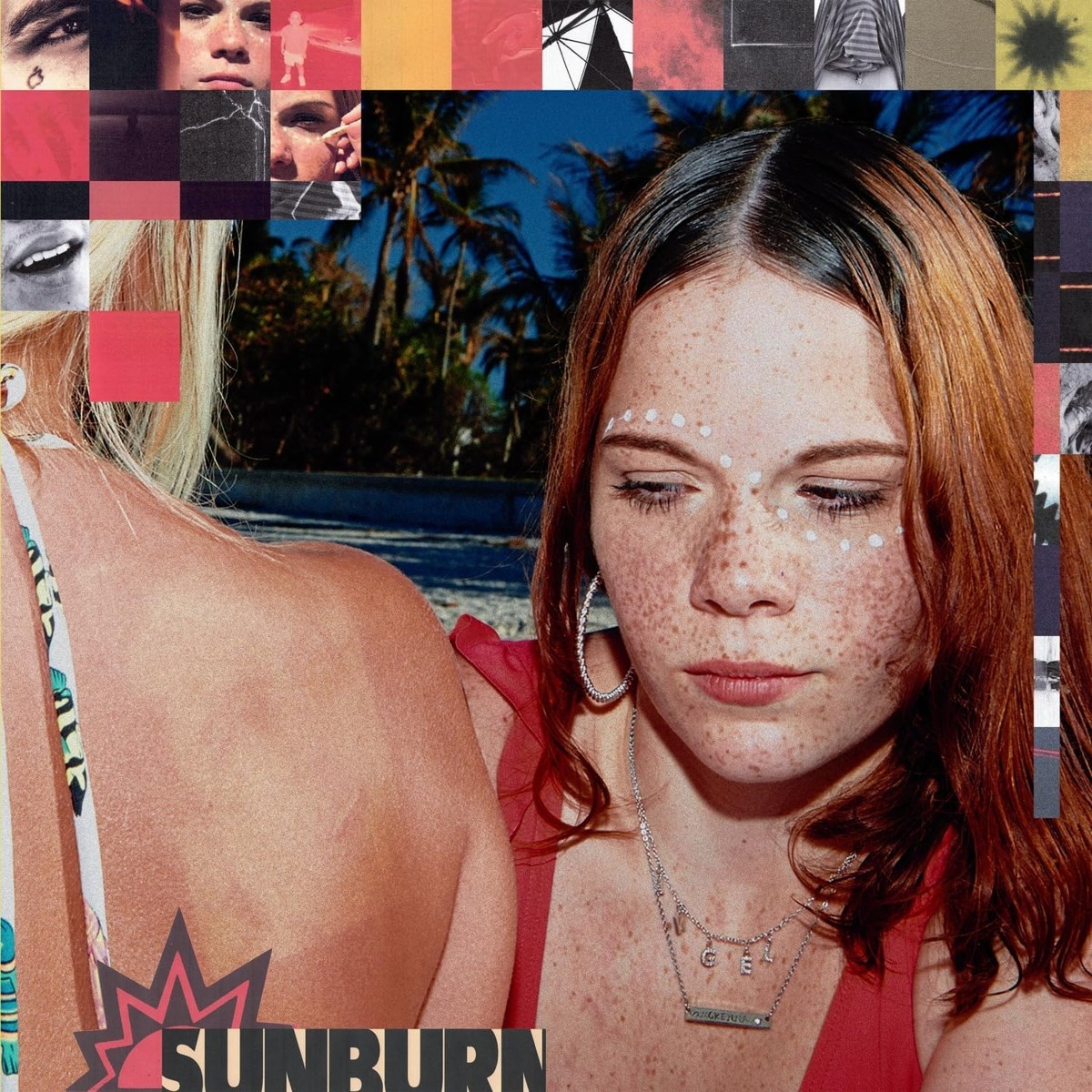 Afbeelding van Sunburn